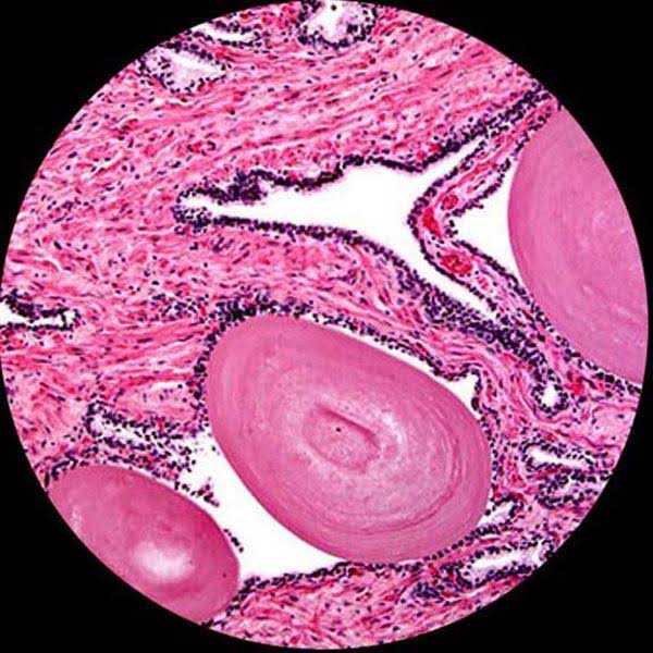 1600X Trinocular Biological Compound Microscope with 14MP Digital Camera U36037